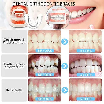 Multifunctional Invisible Silicone Teeth Braces