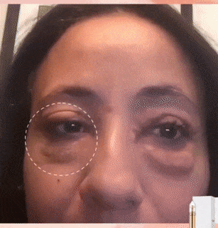 Instant Eye Bag Removal - Mystery Gadgets instant-eye-bag-removal, 