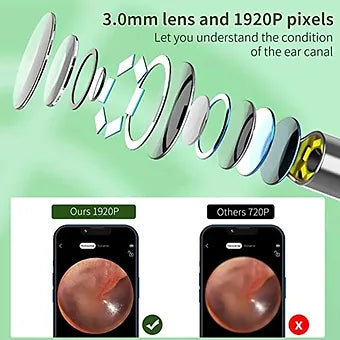 Wireless Endoscope HD Ear Pick Set