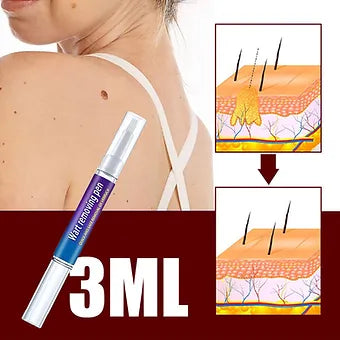 Advanced Herbal Wart Skin Tags Remover