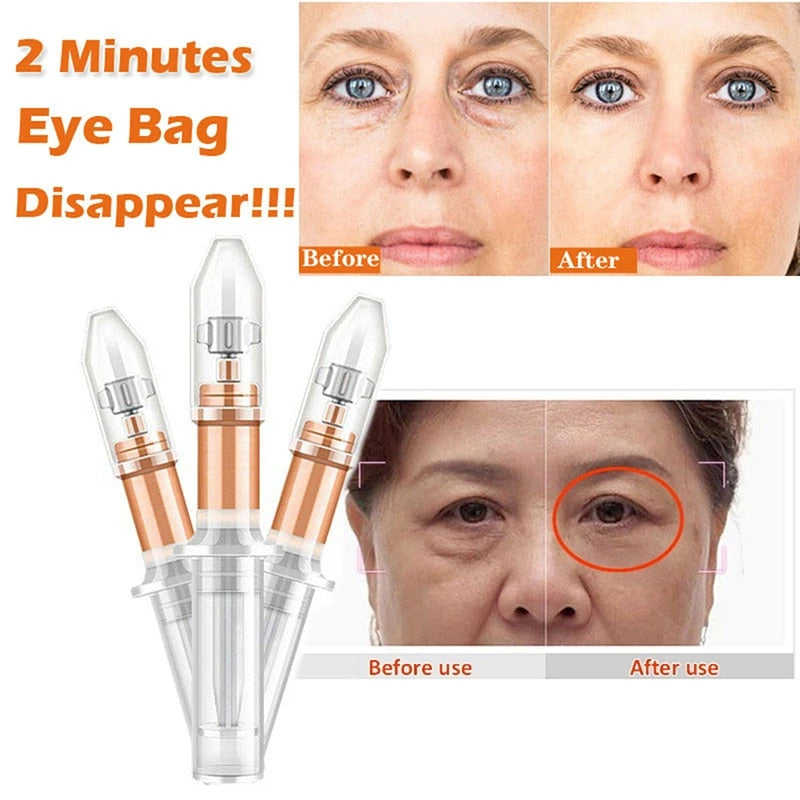 Instant Eye Bag Removal - Mystery Gadgets instant-eye-bag-removal, 