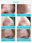 Nose Blackhead Removal Strip