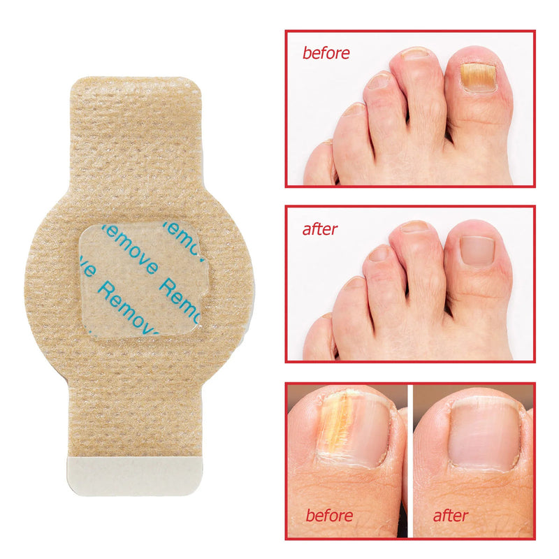Nail Restore Strips