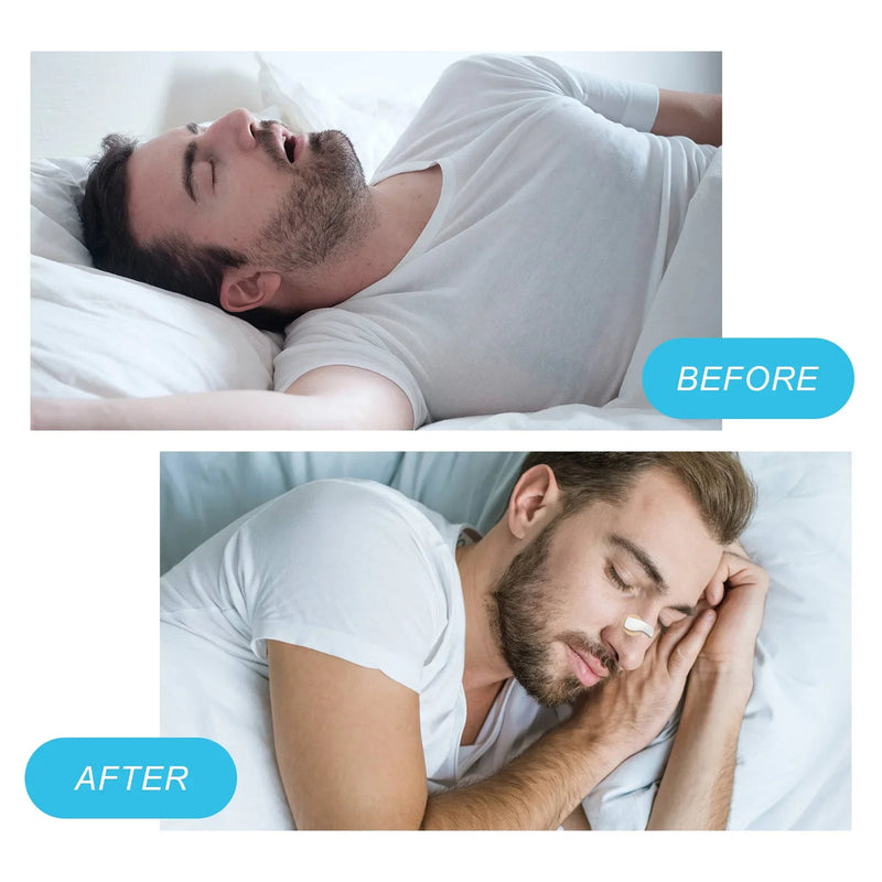 Easy Breath Magnetic Nose Strips