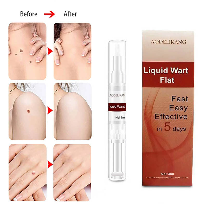 Advanced Herbal Wart Skin Tags Remover