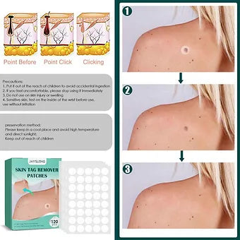 Skin Tag Remover Patches - Mystery Gadgets skin-tag-remover-patches, 