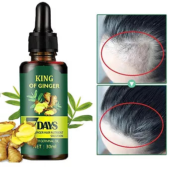 Hair Growth Ginger Oil - Mystery Gadgets hair-growth-ginger-oil, Health & Beauty