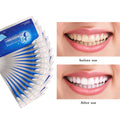 Teeth Whitening Sticker - Mystery Gadgets teeth-whitening-sticker, Health, Health & Beauty