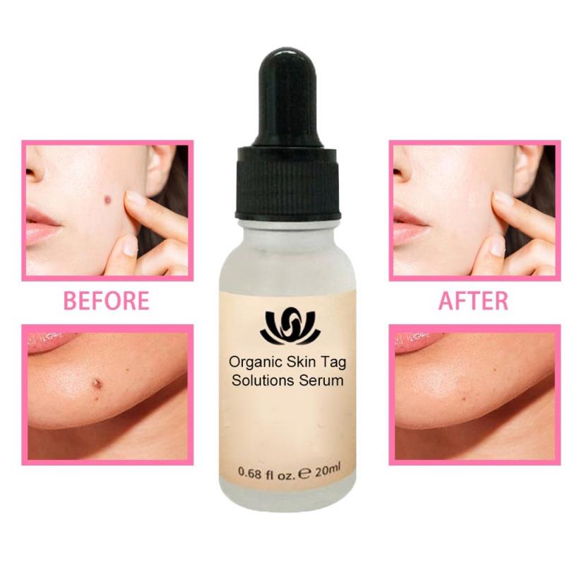 Dark Spot Removal Serum - Mystery Gadgets dark-spot-removal-serum, Health & Beauty