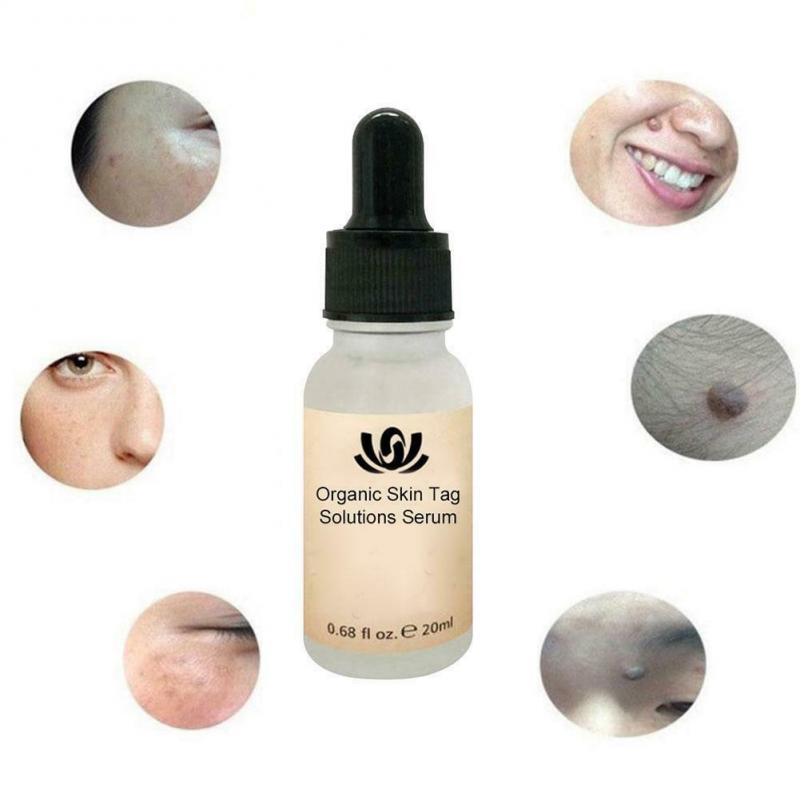 Dark Spot Removal Serum - Mystery Gadgets dark-spot-removal-serum, Health & Beauty
