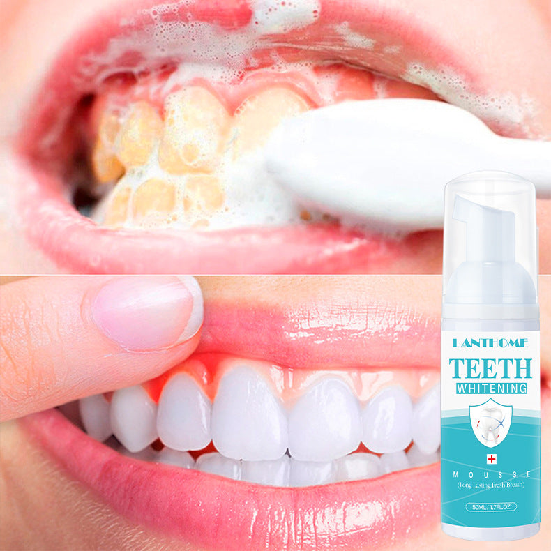 Sparkle White Teeth Mousse - Mystery Gadgets sparkle-white-teeth-mousse, Health & Beauty