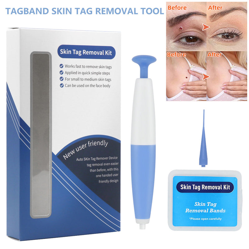 Skin Tag Removal Kit - Mystery Gadgets skin-tag-removal-kit, Health & Beauty