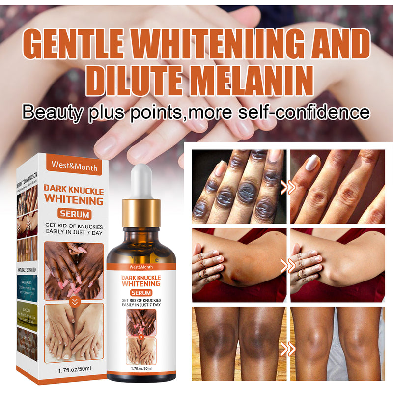 Skin Tone Whitening Serum - Mystery Gadgets skin-tone-whitening-serum, Health & Beauty
