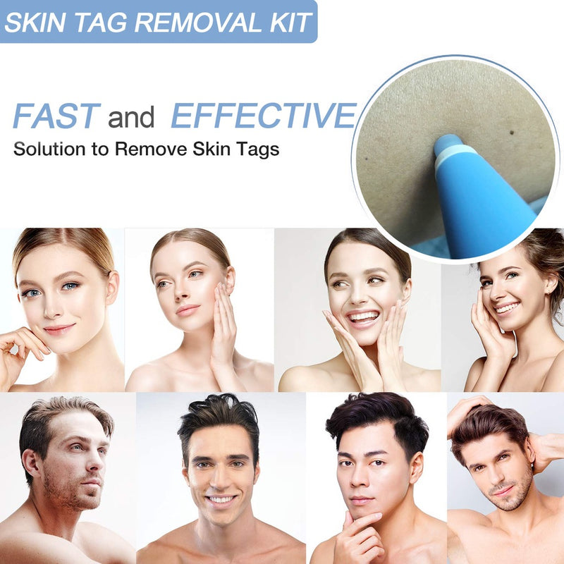 Skin Tag Removal Kit - Mystery Gadgets skin-tag-removal-kit, Health & Beauty