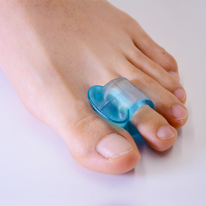Toe Hallux Valgus Corrector - Mystery Gadgets toe-hallux-valgus-corrector, 