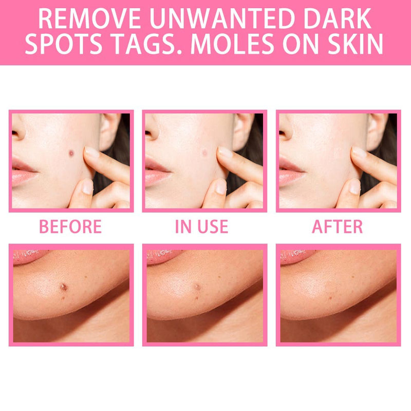 Dark Spot Removal Serum - Mystery Gadgets dark-spot-removal-serum, Health & Beauty