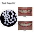 Temporary Tooth Gap Repair Kit - Mystery Gadgets temporary-tooth-gap-repair-kit, Health, Health & Beauty