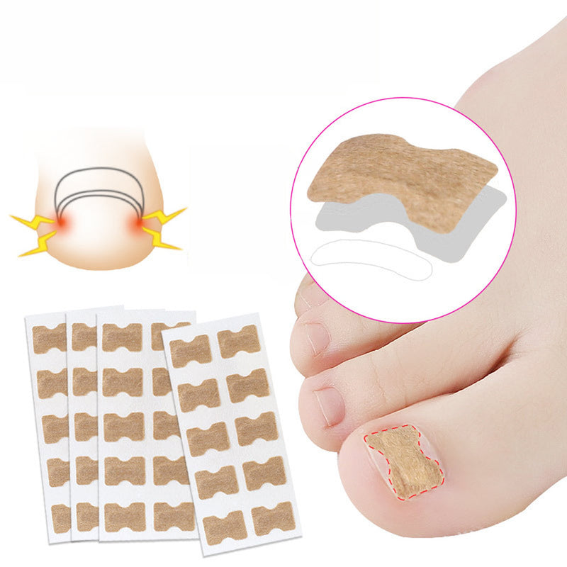 Toenail Correction Stickers - Mystery Gadgets toenail-correction-stickers, Toenail Correction Stickers