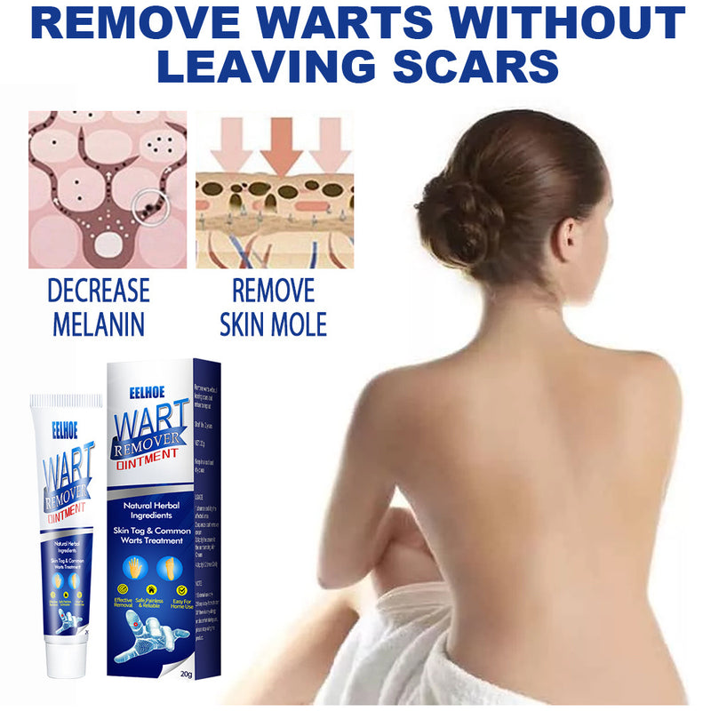 Skin Tag Remover Cream - Mystery Gadgets skin-tag-remover-cream, Health, Health & Beauty