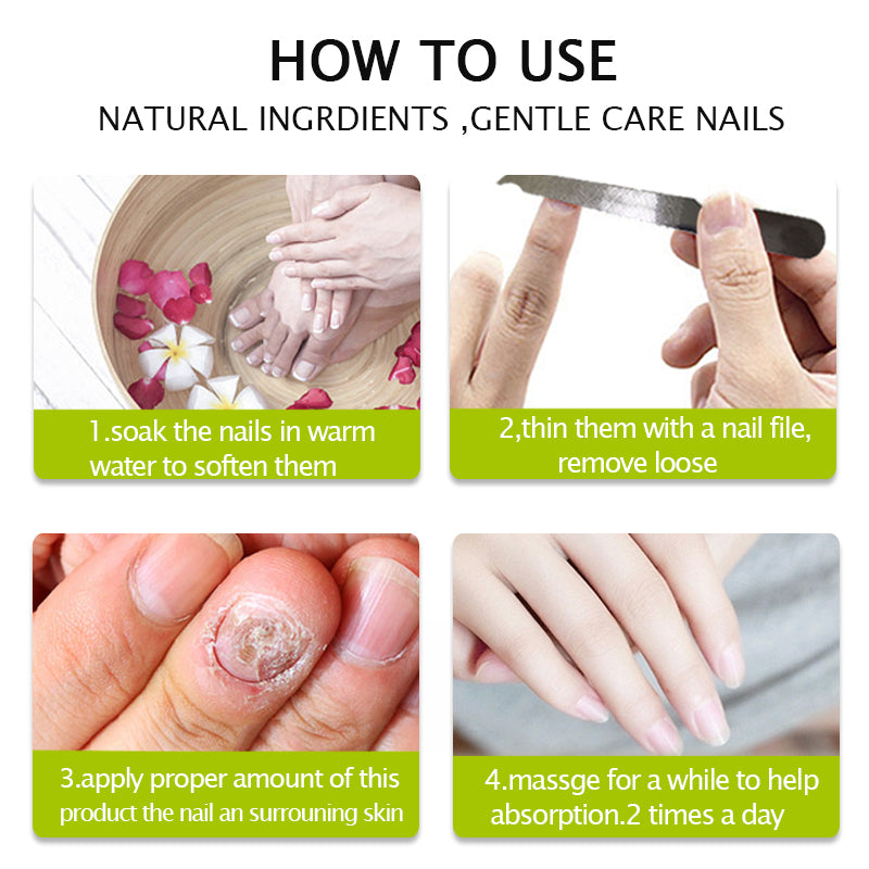 Nail Fungus Defender Serum - Mystery Gadgets nail-fungus-defender-serum, Health & Beauty