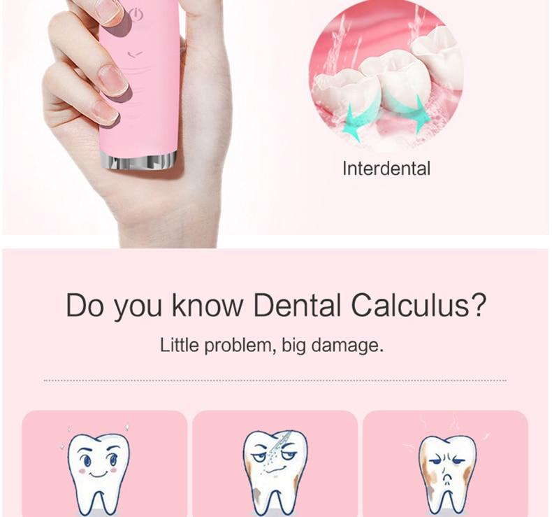 Electric Dental Calculus Remover - Mystery Gadgets electric-dental-calculus-remover, Gadget