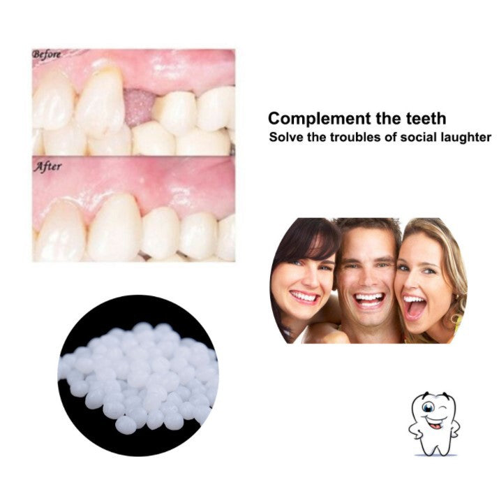 Temporary Tooth Gap Repair Kit - Mystery Gadgets temporary-tooth-gap-repair-kit, Health, Health & Beauty