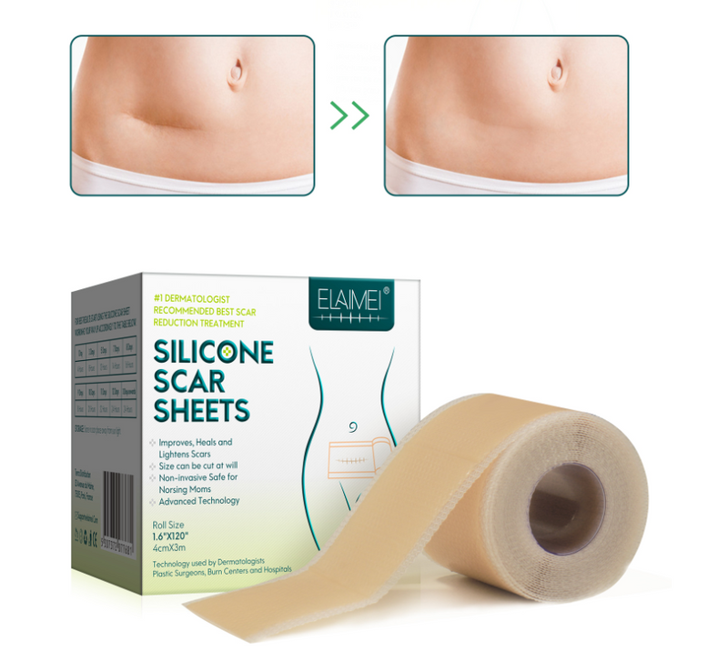 Silicone Scar Patch Removal - Mystery Gadgets silicone-scar-patch-removal, 